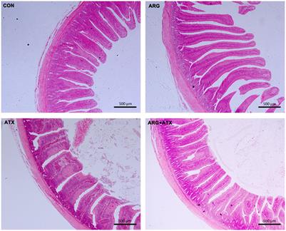 Arginine alleviates Clostridium perfringens α toxin-induced intestinal injury in vivo and in vitro via the SLC38A9/mTORC1 pathway